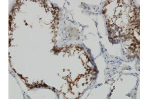 Image no. 1 for anti-POM121 and ZP3 Fusion (POMZP3) (AA 64-116) antibody (ABIN599186) (POMZP3 anticorps  (AA 64-116))