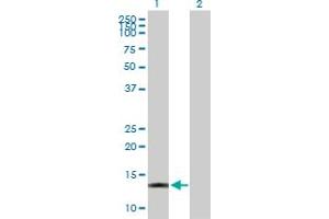 Western Blot analysis of ACOT13 expression in transfected 293T cell line by ACOT13 MaxPab polyclonal antibody. (THEM2 anticorps  (AA 1-140))