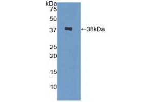 Detection of Recombinant SPINK1, Human using Polyclonal Antibody to Serine Peptidase Inhibitor Kazal Type 1 (SPINK1)