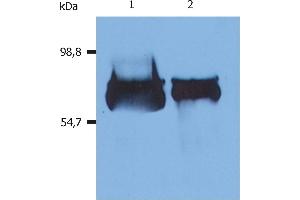 Western Blotting analysis (reducing conditions) of human serum albumin using anti-human Albumin (AL-01). (Albumin anticorps)