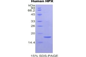 SDS-PAGE of Protein Standard from the Kit (Highly purified E. (Hemopexin Kit CLIA)