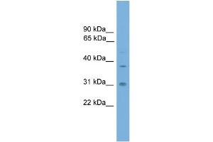 WB Suggested Anti-AIP Antibody Titration: 0. (AIP anticorps  (Middle Region))