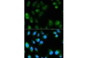 Immunofluorescence analysis of MCF7 cell using UCP3 antibody. (UCP3 anticorps)