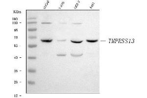 Western blot analysis of TMPRSS13 using anti-TMPRSS13 antibody (ABIN7599797). (TMPRSS13 anticorps  (AA 118-572))