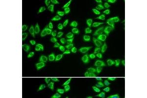 Immunofluorescence analysis of A549 cells using HADHB Polyclonal Antibody (HADHB anticorps)