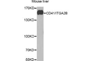 Western blot analysis of extracts of mouse liver, using CD41/CD41/ITGB antibody (ABIN6129287, ABIN6142560, ABIN6142562 and ABIN6221333) at 1:1000 dilution. (Integrin Alpha2b anticorps  (AA 693-993))