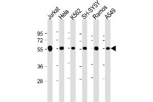 All lanes : Anti-CALR Antibody (Center) at 1:2000 dilution Lane 1: Jurkat whole cell lysate Lane 2: Hela whole cell lysate Lane 3: K562 whole cell lysate Lane 4: SH-SY5Y whole cell lysate Lane 5: Ramos whole cell lysate Lane 6: A549 whole cell lysate Lysates/proteins at 20 μg per lane.