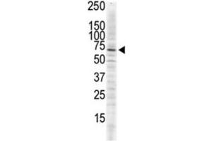 Western Blotting (WB) image for anti-Calcium/calmodulin-Dependent Protein Kinase II delta (CAMK2D) antibody (ABIN5023065) (CAMK2D anticorps)