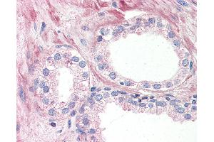 Anti-OR51E1 antibody IHC of human prostate. (OR51E1 anticorps  (Internal Region))