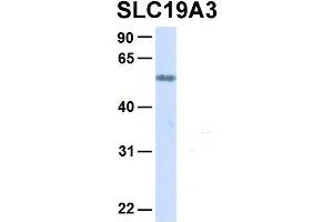Host:  Rabbit  Target Name:  SLC19A3  Sample Type:  Human Adult Placenta  Antibody Dilution:  1.