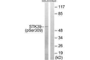 Western blot analysis of extracts from COLO cells using STK39 (Phospho-Ser309) Antibody. (STK39 anticorps  (pSer311))