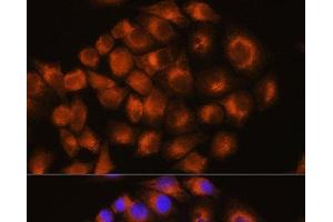 Immunofluorescence analysis of HeLa cells using ADORA2A Polyclonal Antibody at dilution of 1:100.