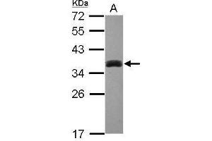 WB Image Sample (30 ug of whole cell lysate) A: HepG2 12% SDS PAGE antibody diluted at 1:1000 (SULT1A3 anticorps  (Center))