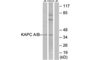 Western blot analysis of extracts from COLO/Jurkat cells, using KAPC A/B Antibody. (KAPC A/B (AA 1-50) anticorps)