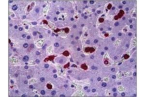 Human Liver: Formalin-Fixed, Paraffin-Embedded (FFPE)