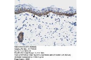Human Skin (NUDT9 anticorps  (C-Term))