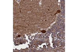 Immunohistochemical staining of human cerebellum with PLP2 polyclonal antibody  shows strong cytoplasmic positivity in purkinje cells at 1:50-1:200 dilution. (PLP2 anticorps)