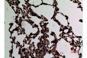 Immunohistochemistry (IHC) analysis of paraffin-embedded Rat Lung, antibody was diluted at 1:100. (STAT2 anticorps  (Tyr1221, Tyr1222))