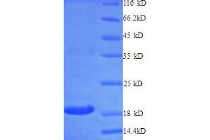 SDS-PAGE (SDS) image for CD40 Ligand (CD40LG) (AA 113-261) protein (His tag) (ABIN5709233)
