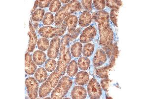 Immunohistochemistry of paraffin-embedded rat kidney using NEK6 Rabbit mAb (ABIN7268916) at dilution of 1:100 (40x lens).