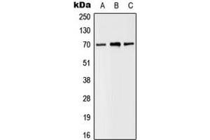 Western blot analysis of SLC6A8 expression in MDAMB435 (A), Raw264.