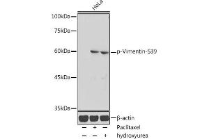 Western blot analysis of extracts of HeLa cells, using Phospho-Vimentin-S39 antibody (ABIN7271327) at 1:1000 dilution.