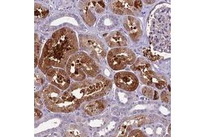 Immunohistochemical staining of human kidney with CILP2 polyclonal antibody  shows moderate cytoplasmic positivity in cells in tubules at 1:200-1:500 dilution. (Cilp2 anticorps)