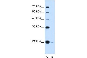 WB Suggested Anti-XTP3TPA Antibody Titration:  0. (DCTPP1 anticorps  (Middle Region))