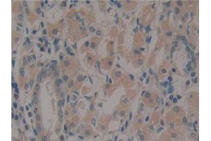 Detection of PXN in Human Stomach Tissue using Polyclonal Antibody to Paxillin (PXN)