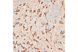 Immunohistochemistry of paraffin-embedded rat brain using Musashi-2 (Musashi-2 (MSI2)) Rabbit mAb (ABIN7268701) at dilution of 1:100 (40x lens).