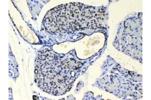IHC testing of FFPE mouse pancreas tissue with COPE antibody at 1ug/ml. (COPE anticorps)