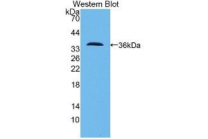Detection of Recombinant PCNT, Human using Polyclonal Antibody to Pericentrin (PCNT) (PCNT anticorps  (AA 2987-3246))