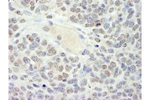 Immunohistochemistry (IHC) image for anti-High Mobility Group Box 3 (HMGB3) (AA 125-175) antibody (ABIN7448596) (HMGB3 anticorps  (AA 125-175))