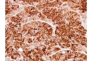 IHC-P Image Immunohistochemical analysis of paraffin-embedded SW480 xenograft, using Cystatin S, antibody at 1:100 dilution.