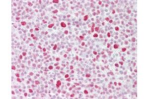 Anti-PSME3 antibody IHC of human tonsil.