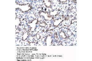 Human Lung (Endoglin anticorps  (N-Term))