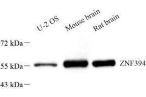 Western blot analysis of ZNF394 (ABIN7076266) at dilution of 1: 1500 (ZNF394 anticorps)