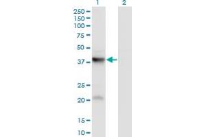 Western Blot analysis of PANK3 expression in transfected 293T cell line by PANK3 monoclonal antibody (M01), clone 3D7. (PANK3 anticorps  (AA 1-370))