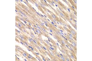 Immunohistochemistry of paraffin-embedded rat heart using SLC25A4 antibody (ABIN5970965) at dilution of 1/100 (40x lens). (SLC25A4 anticorps)