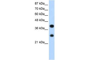 WB Suggested Anti-PCBP2 Antibody Titration:  1. (PCBP2 anticorps  (Middle Region))