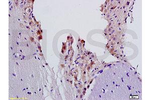 Formalin-fixed and paraffin embedded rat brain tissue labeled with Anti-ADRB2 Polyclonal Antibody, Unconjugated (ABIN730153) at 1:200, followed by conjugation to the secondary antibody and DAB staining