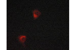 ABIN6268921 staining LOVO cells by ICC/IF. (HSPD1 anticorps)