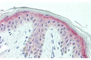Detection of CSPG4 in Human Skin Tissue using Polyclonal Antibody to Chondroitin Sulfate Proteoglycan 4 (CSPG4)