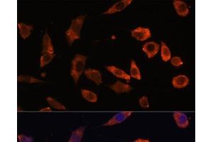 Immunofluorescence analysis of L929 cells using RAB5B Polyclonal Antibody at dilution of 1:100. (RAB5B anticorps)