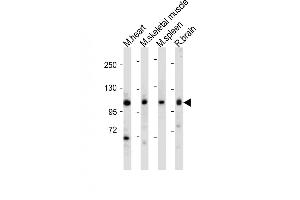 All lanes : Anti-Mouse Csf1r Antibody (C-term) at 1:1000-2000 dilution Lane 1: Mouse heart tissue lysate Lane 2: Mouse skeletal muscle tissue lysate Lane 3: Mouse spleen tissue lysate Lane 4: Rat brain tissue lysate Lysates/proteins at 20 μg per lane. (CSF1R anticorps  (C-Term))