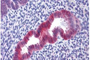 Human Uterus: Formalin-Fixed, Paraffin-Embedded (FFPE) (IDH1 anticorps  (C-Term))