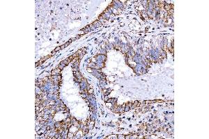 IHC analysis of RAB7/RAB7A using anti-RAB7/RAB7A antibody (ABIN7600597). (RAB7A anticorps  (AA 21-177))