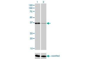 Western blot analysis of PITX1 over-expressed 293 cell line, cotransfected with PITX1 Validated Chimera RNAi (Lane 2) or non-transfected control (Lane 1).