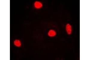 Immunofluorescent analysis of RNF40 staining in MCF7 cells. (RNF40 anticorps)