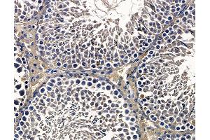 ABIN7097097 and ABIN7101164 at 1/100 staining rat testis tissue by IHC-P. (CCDC3 anticorps)